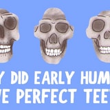 How Did Early Humans Have Better Teeth Than Us?