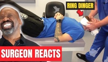 waarde lekken Klas Orthopedic Surgeon Reacts To These Painful-Looking Chiropractic Ring Dingers  And Explains What Patients Are Feeling | Digg