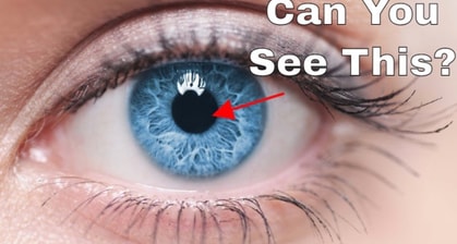 Have Your Mind Blown By This Explanation About How To See Inside Your Own Eyeball
